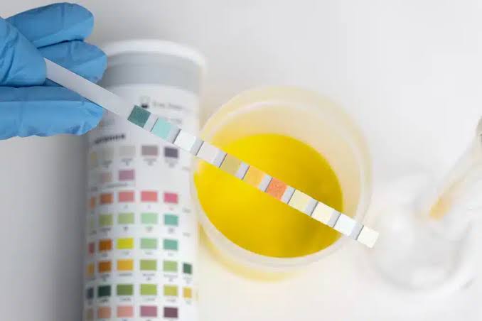 Does Ketamine Show Up on a 14-Panel Drug Test?